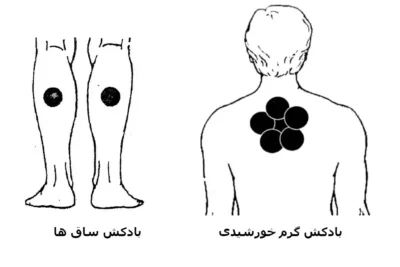 نقاط بادکش گذاری