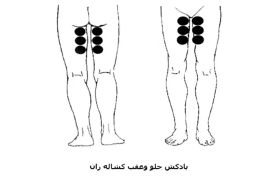 نقاط بادکش گذاری