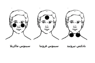 نقاط بادکش گذاری