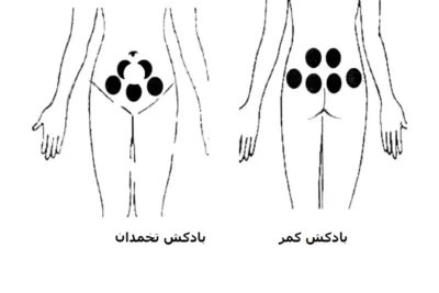 نقاط بادکش گذاری