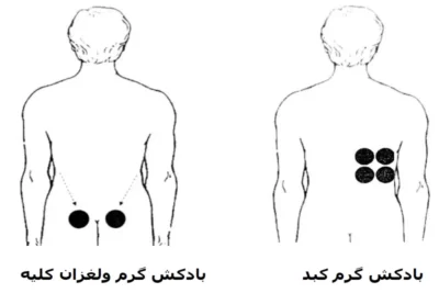 نقاط بادکش گذاری