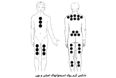 نقاط بادکش گذاری