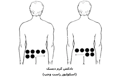 نقاط بادکش گذاری