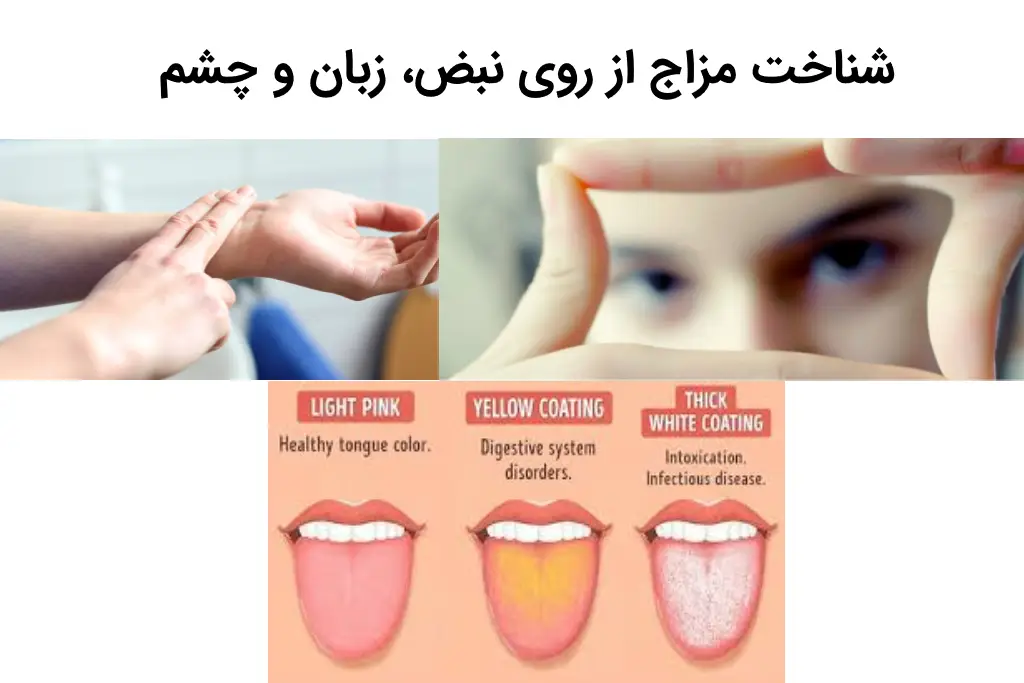 شناخت مزاج از روی نبض، زبان و چشم