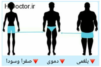 تشخیص مزاج